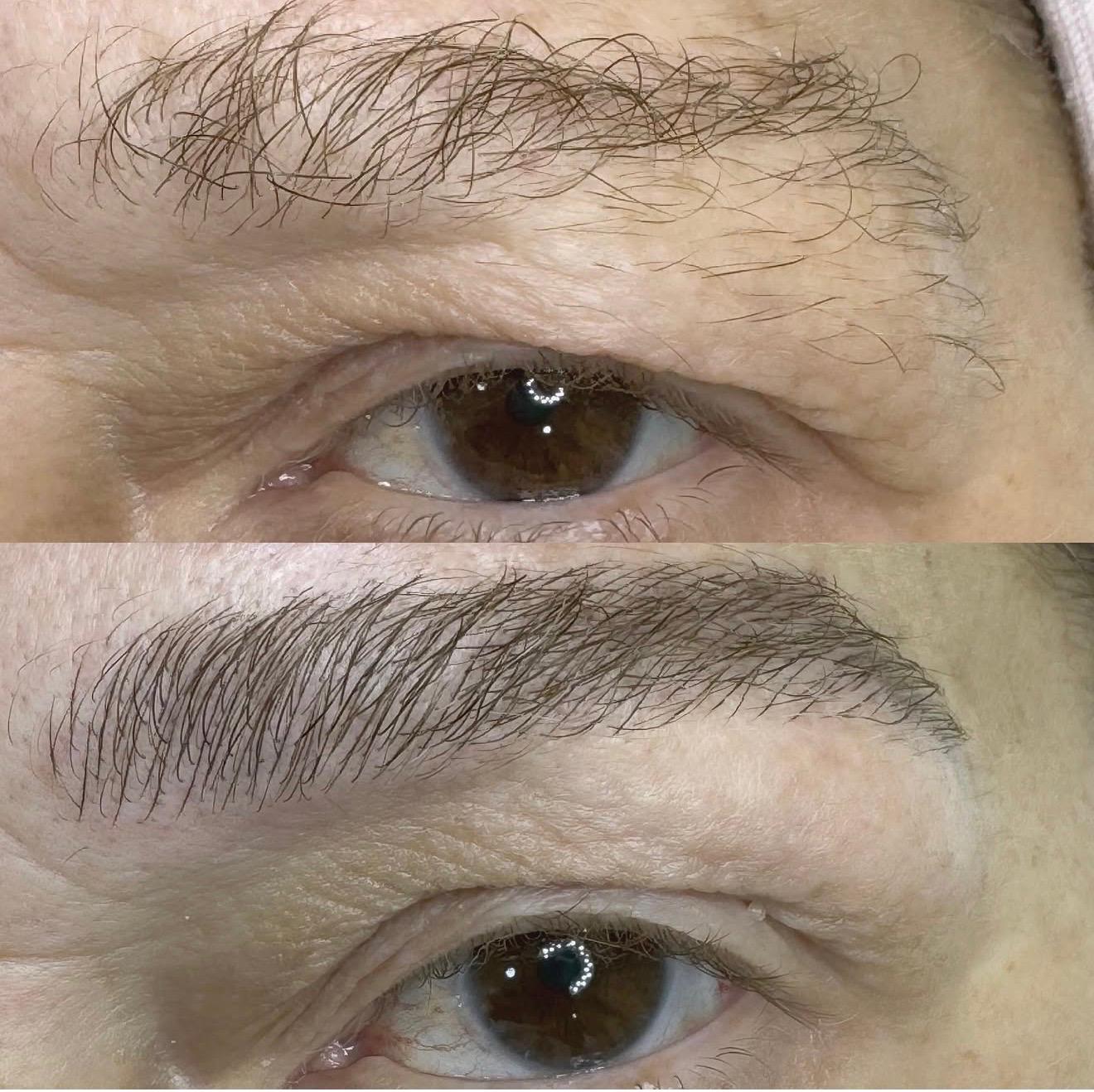 Antes e depois design de sobrancelhas