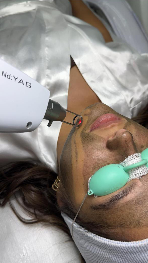 Black peel peeling de Hollywood